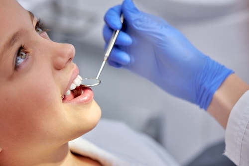 dental sealants Evanston